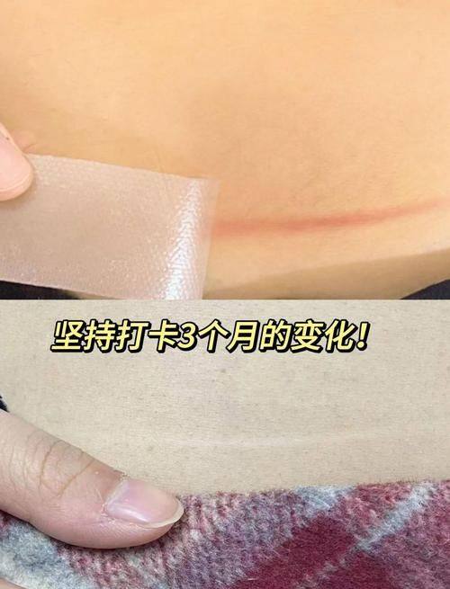 沈阳创美荟整形医院收费价格表/收费标准