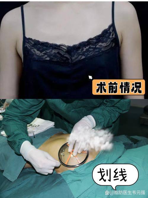 上海辰新医院医学美容科特色项目及技术优势
