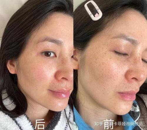 吴钟卓医生擅长项目