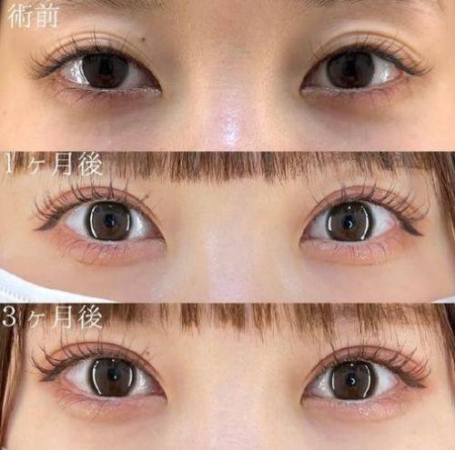 上海辰新医院医学美容科是正规医院吗？
