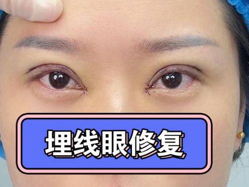 重庆莱普医学整形门诊部是正规医院吗？