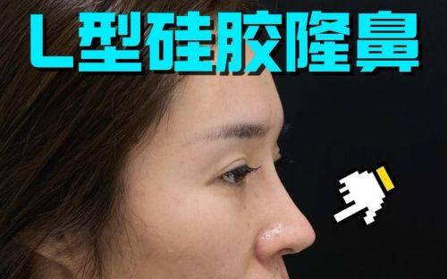 侯怡医生坐诊医院