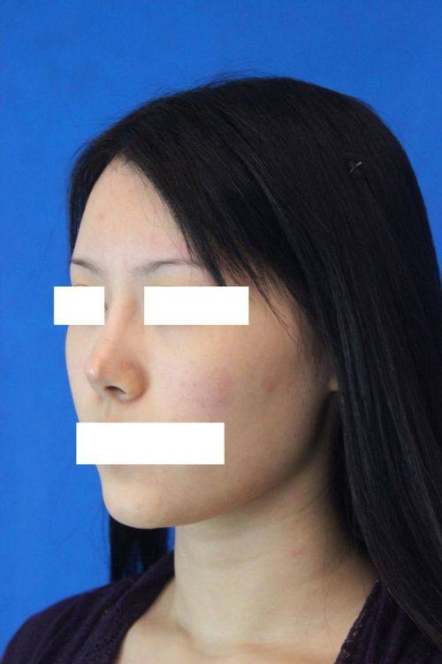 南昌姬妍整形医院详细的预约挂号方式及流程