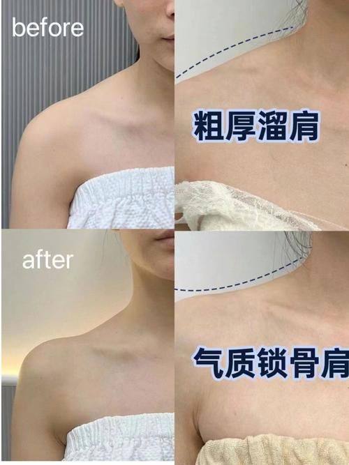 长沙摩莉医疗美容门诊部治疗反馈与口碑评价。