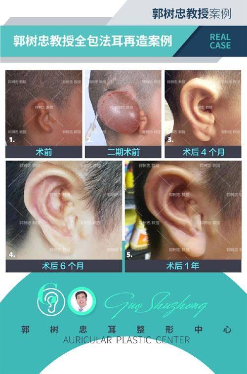 上海辰新医院医学美容科详细的预约挂号方式及流程