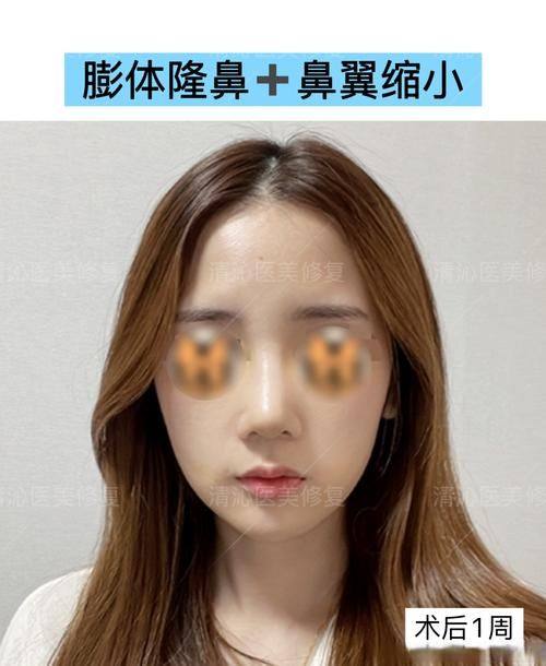重庆莱普医学整形门诊部特色项目及技术优势
