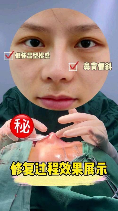 侯怡医生技术优势