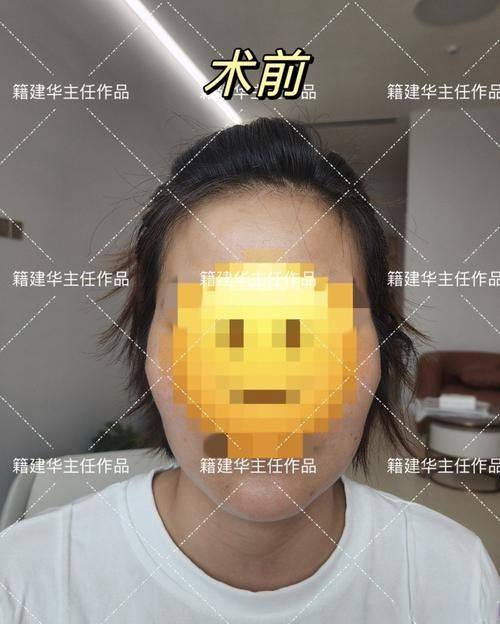 朱启刚医生技术实力展现