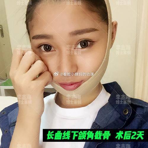 天津童妍医疗美容诊所真人口碑评价怎么样？