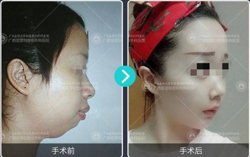 义乌玺颜整形医院预约挂号方式。