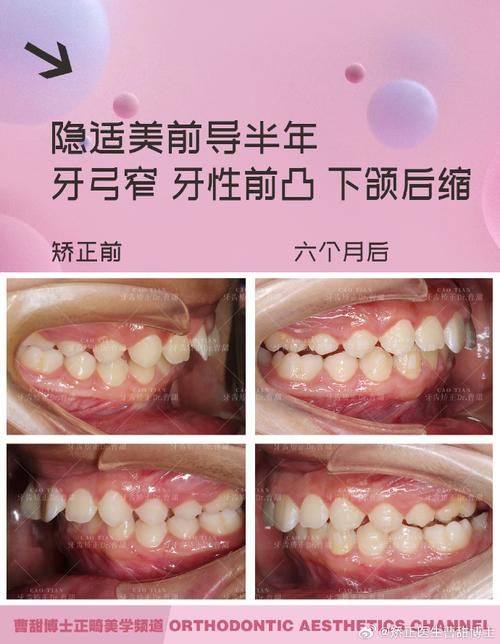 山西侯马王琳口腔预约挂号方式。