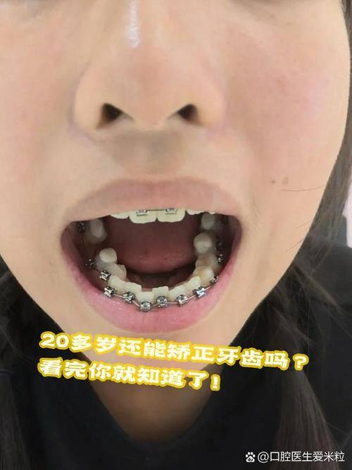 山西侯马王琳口腔治疗反馈与口碑评价。