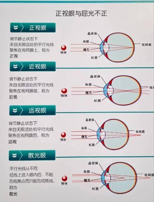 广州爱尔暨丽眼科门诊部擅长项目。
